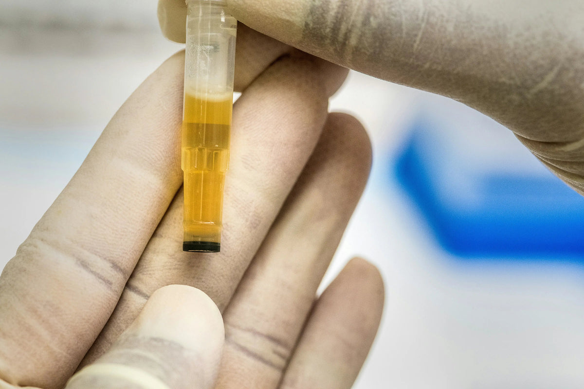 vial of urine in a lab setting